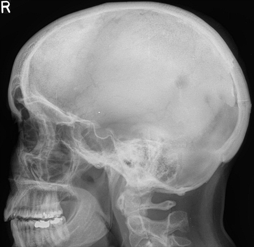 Skull - Radiology Study Aids